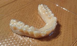 Dentale (2)